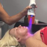 Cryotherapy for the face